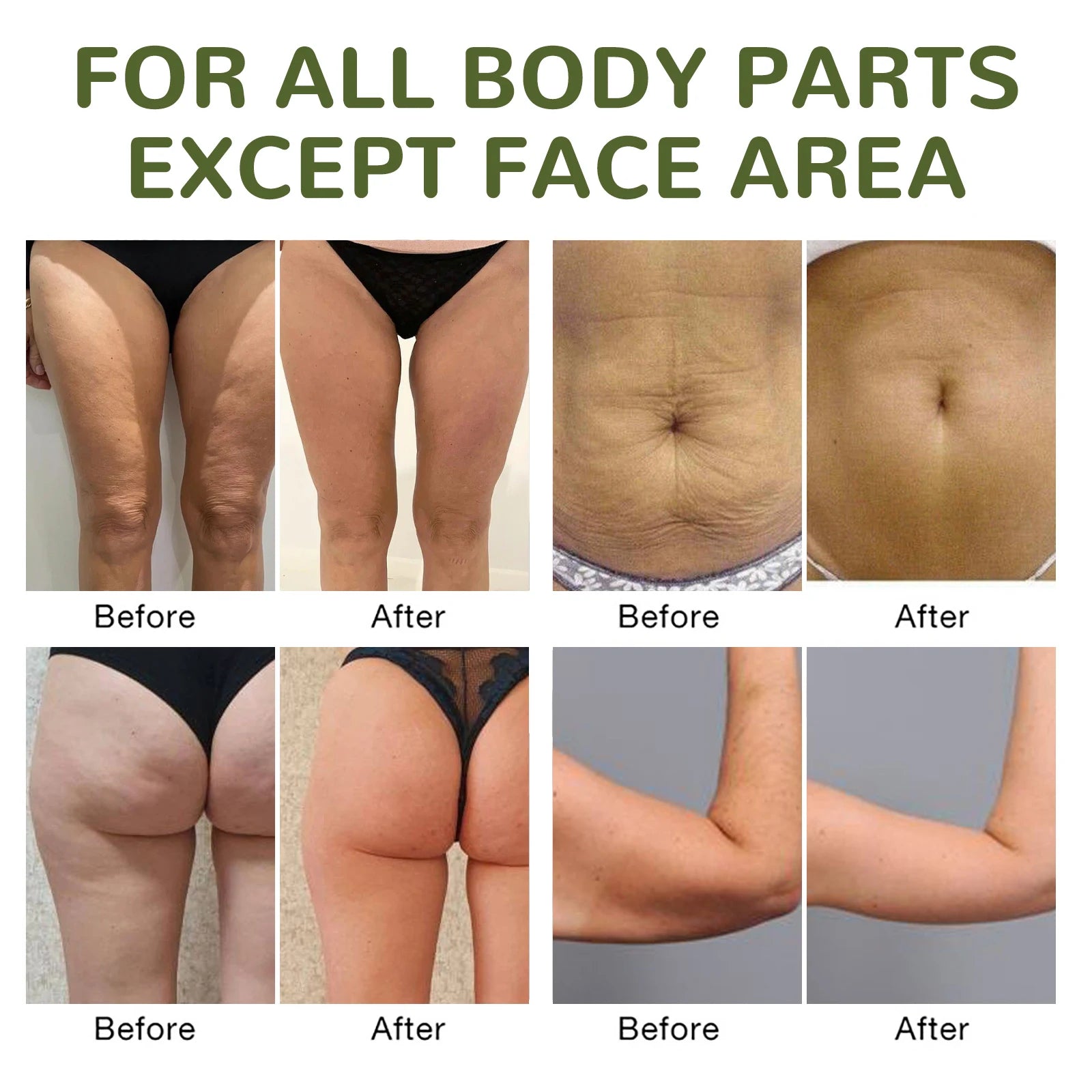 Lifting Body Oil – Tighten, Firm & Hydrate Skin