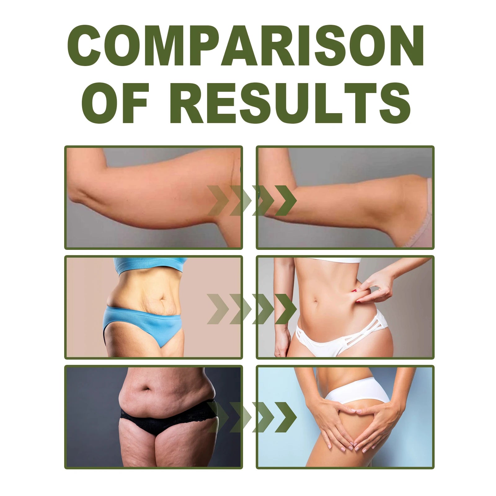 Lifting Body Oil – Tighten, Firm & Hydrate Skin