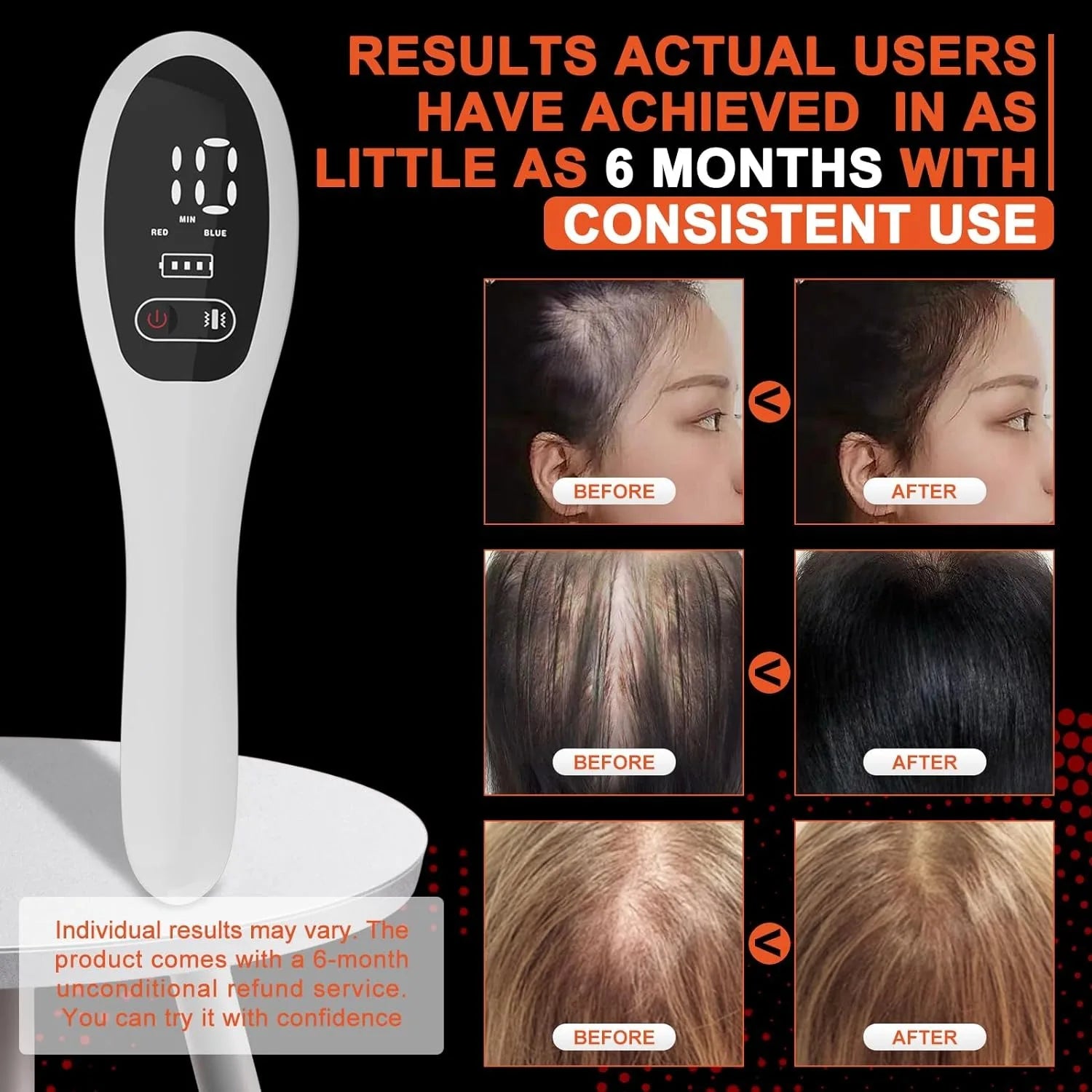 Laser Hair Growth Comb – LED Light & Massage Therapy